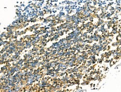 Invitrogen CD20 Polyclonal Antibody 100 &mu;L; Unconjugated:Antikörper