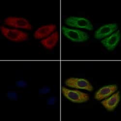 Invitrogen CD248 Polyclonal Antibody 100 &mu;L | Buy Online | Invitrogen&trade; | Fisher Scientific