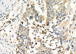 Invitrogen CD248 Polyclonal Antibody 100 &mu;L | Buy Online | Invitrogen&trade; | Fisher Scientific