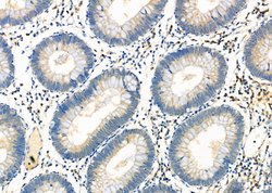 Invitrogen CD26 Polyclonal Antibody 100 &mu;L; Unconjugated:Antibodies,