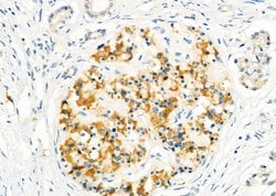 Invitrogen CD26 Polyclonal Antibody 100 &mu;L; Unconjugated:Antibodies,