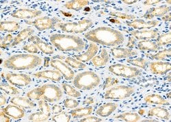 Invitrogen CD26 Polyclonal Antibody 100 &mu;L; Unconjugated:Antibodies,