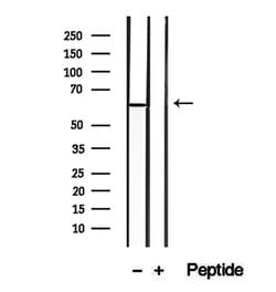 Invitrogen CD26 Polyclonal Antibody 100 &mu;L; Unconjugated:Antibodies,