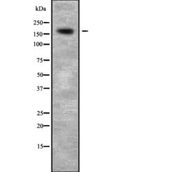 Invitrogen CDK12 Polyclonal Antibody 100 &mu;L; Unconjugated:Antibodies,