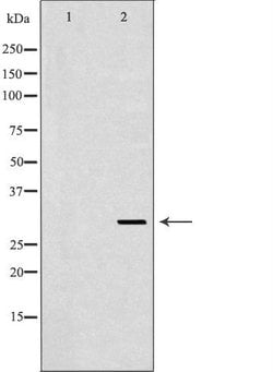 Invitrogen CD154 (CD40 Ligand) Polyclonal Antibody 100 &mu;L; Unconjugated:Antibodies,