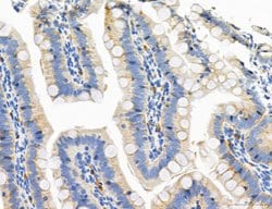 Invitrogen CD44 Polyclonal Antibody 100 &mu;L; Unconjugated:Antibodies,
