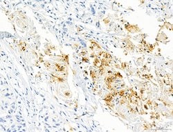 Invitrogen CD44 Polyclonal Antibody 100 &mu;L; Unconjugated:Antibodies,