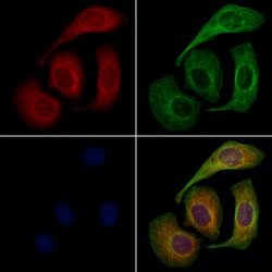 Invitrogen CD47 Polyclonal Antibody 100 &mu;L; Unconjugated:Antibodies,