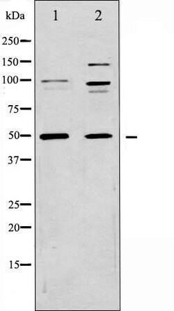 Invitrogen CD47 Polyclonal Antibody 100 &mu;L; Unconjugated:Antibodies,