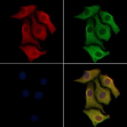 Invitrogen CD69 Polyclonal Antibody 100 &mu;L; Unconjugated:Antibodies,