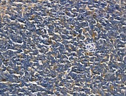 Invitrogen CD69 Polyclonal Antibody 100 &mu;L; Unconjugated:Antibodies,