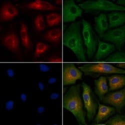 Invitrogen CD7 Polyclonal Antibody 100 &mu;L; Unconjugated:Antibodies,