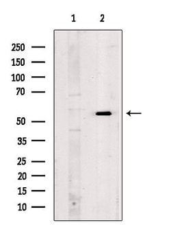 Invitrogen CD7 Polyclonal Antibody 100 &mu;L; Unconjugated:Antibodies,