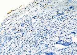 Invitrogen CD8 Polyclonal Antibody 100 &mu;L; Unconjugated:Antibodies,