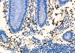 Invitrogen CD8 Polyclonal Antibody 100 &mu;L; Unconjugated:Antibodies,