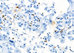 Invitrogen CD8 Polyclonal Antibody 100 &mu;L; Unconjugated:Antibodies,
