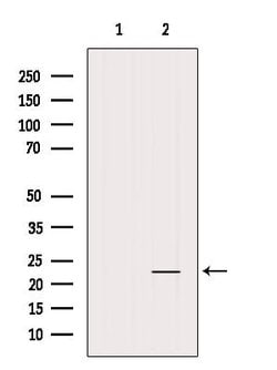 Invitrogen CD83 Polyclonal Antibody 100 &mu;L | Buy Online | Invitrogen&trade; | Fisher Scientific