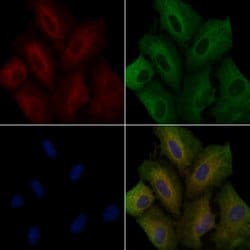 Invitrogen CD86 Polyclonal Antibody 100 &mu;L; Unconjugated:Antibodies,