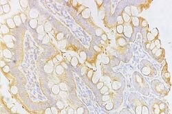 Invitrogen CD8 Polyclonal Antibody 100 &mu;L; Unconjugated:Antibodies,