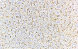 Invitrogen CD8 Polyclonal Antibody 100 &mu;L; Unconjugated:Antibodies,