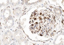 Invitrogen H-cadherin Polyclonal Antibody 100 &mu;L; Unconjugated:Antibodies,