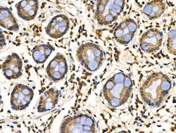 Invitrogen CDK8 Polyclonal Antibody 100 &mu;L | Buy Online | Invitrogen&trade; | Fisher Scientific