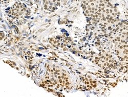 Invitrogen CDK8 Polyclonal Antibody 100 &mu;L | Buy Online | Invitrogen&trade; | Fisher Scientific