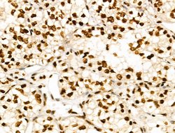 Invitrogen CDK8 Polyclonal Antibody 100 &mu;L | Buy Online | Invitrogen&trade; | Fisher Scientific