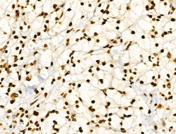 Invitrogen CDK8 Polyclonal Antibody 100 &mu;L | Buy Online | Invitrogen&trade; | Fisher Scientific