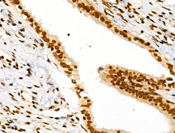 Invitrogen CDK8 Polyclonal Antibody 100 &mu;L | Buy Online | Invitrogen&trade; | Fisher Scientific