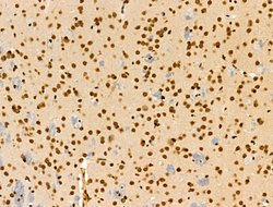 Invitrogen CDK8 Polyclonal Antibody 100 &mu;L | Buy Online | Invitrogen&trade; | Fisher Scientific