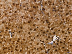 Invitrogen CDK8 Polyclonal Antibody 100 &mu;L | Buy Online | Invitrogen&trade; | Fisher Scientific
