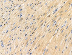 Invitrogen CDK8 Polyclonal Antibody 100 &mu;L | Buy Online | Invitrogen&trade; | Fisher Scientific