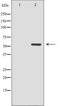 Invitrogen CDK8 Polyclonal Antibody 100 &mu;L | Buy Online | Invitrogen&trade; | Fisher Scientific