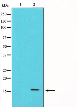 Invitrogen p16INK4a Polyclonal Antibody 100 &mu;L; Unconjugated:Antibodies,