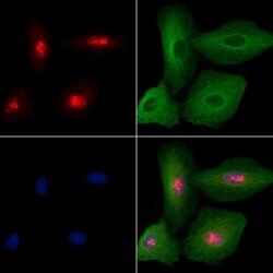 Invitrogen CEACAM19 Polyclonal Antibody 100 &mu;L; Unconjugated:Antibodies,