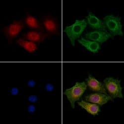 Invitrogen CENPB Polyclonal Antibody 100 &mu;L; Unconjugated:Antibodies,