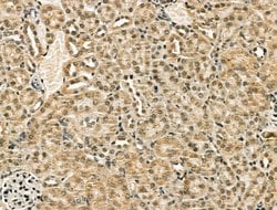 Invitrogen CENPB Polyclonal Antibody 100 &mu;L; Unconjugated:Antibodies,