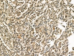 Invitrogen CENPB Polyclonal Antibody 100 &mu;L; Unconjugated:Antibodies,