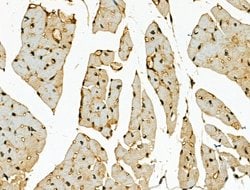 Invitrogen CENPB Polyclonal Antibody 100 &mu;L; Unconjugated:Antibodies,