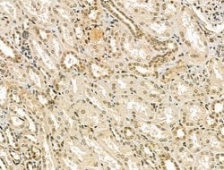 Invitrogen CENPB Polyclonal Antibody 100 &mu;L; Unconjugated:Antibodies,
