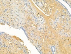 Invitrogen CHL1 Polyclonal Antibody 100 &mu;L; Unconjugated:Antibodies,