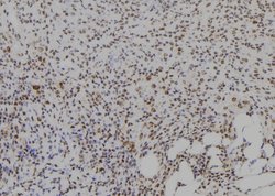 CIDEA Polyclonal Antibody:Antibodies, Polyclonal