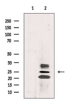 CIDEA Polyclonal Antibody:Antibodies, Polyclonal