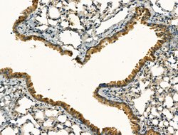 Invitrogen Clathrin Heavy Chain Polyclonal Antibody 100 &mu;L; Unconjugated:Antibodies,