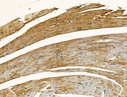 Invitrogen Clathrin Heavy Chain Polyclonal Antibody 100 &mu;L; Unconjugated:Antibodies,
