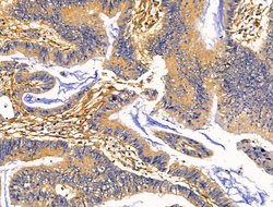 Invitrogen CLCA3P Polyclonal Antibody 100 &mu;L | Buy Online | Invitrogen&trade; | Fisher Scientific