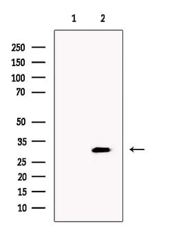 Invitrogen CLCA3P Polyclonal Antibody 100 &mu;L | Buy Online | Invitrogen&trade; | Fisher Scientific