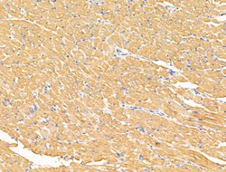 Invitrogen CLPB Polyclonal Antibody 100 &mu;L | Buy Online | Invitrogen&trade; | Fisher Scientific
