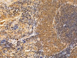Invitrogen CLPB Polyclonal Antibody 100 &mu;L | Buy Online | Invitrogen&trade; | Fisher Scientific